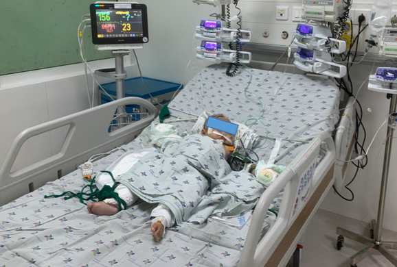 Bà vừa bế cháu vừa nướng mực khiến trẻ 6 tháng tuổi gặp nạn