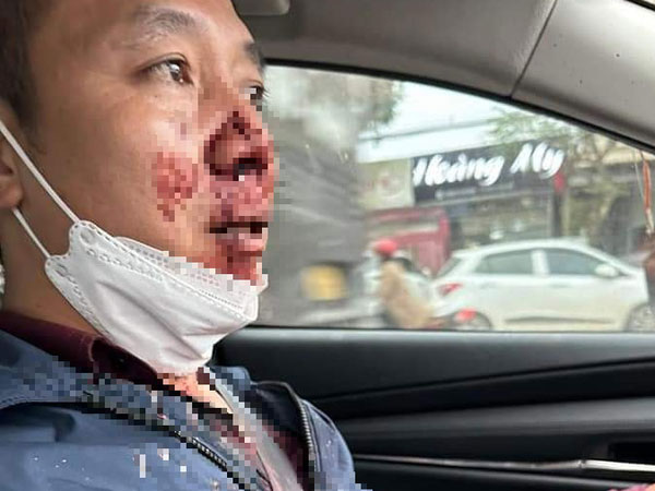 Táo tợn chặn ôtô của thầy giáo cướp tài sản giữa ban ngày