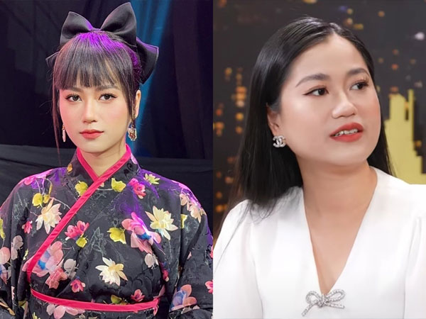 Lâm Vỹ Dạ vướng nghi vấn 'đụng dao kéo' chỉ vì nhan sắc ngày càng thăng hạng