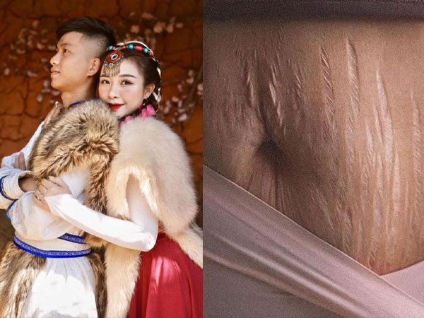 Vợ Phan Văn Đức khoe da bụng bị rạn, lộ phản ứng của chồng