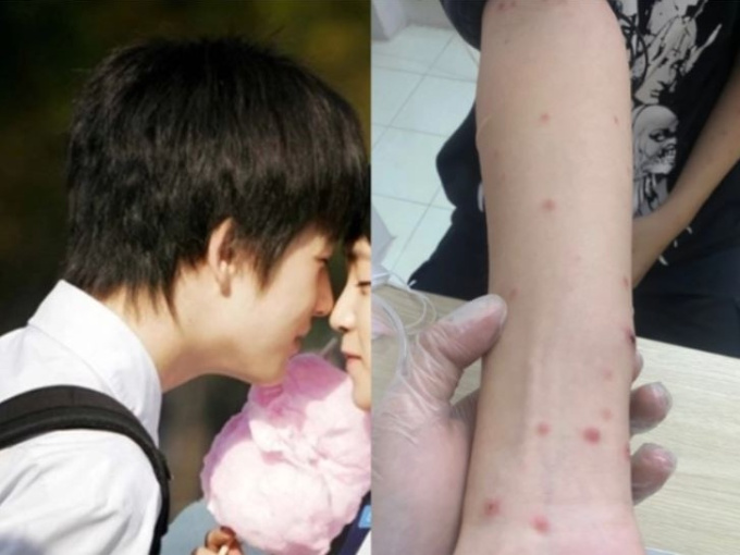 Bé 14 tuổi nhiễm HIV, giang mai, nghi sùi mào gà: Cảnh báo quan hệ tình dục sớm ở tuổi vị thành niên