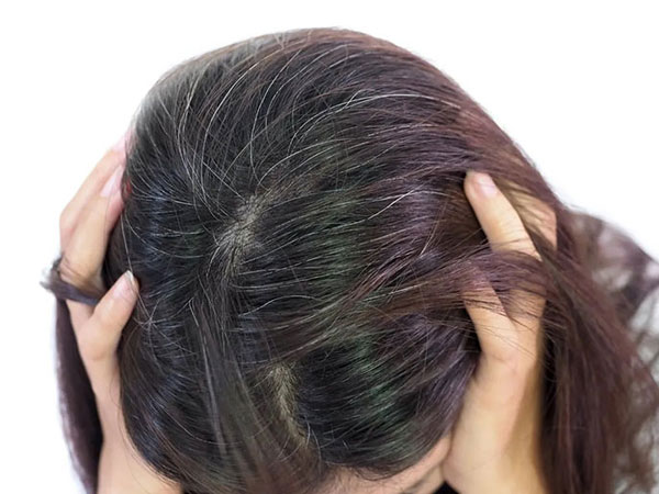 Tóc bạc sớm có phải do 'máu xấu'?