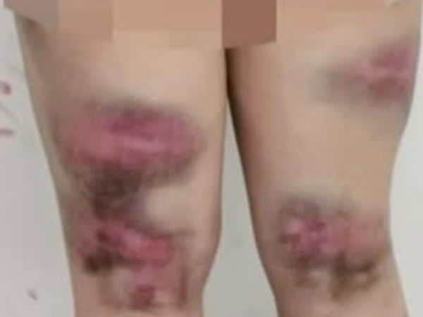 Bị mẹ vác gậy đánh bầm tím cả người vì 30 tuổi chưa có người yêu và cái kết gây sốc