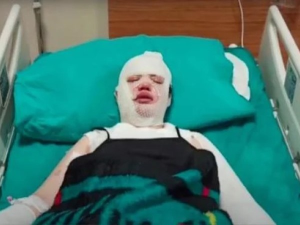 Người phụ nữ đang ngủ bị dội nước sôi vào người, không ngờ danh tính hung thủ