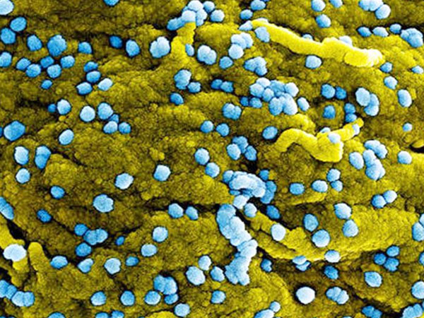 Virus Marburg được WHO cảnh báo nguy hiểm thế nào?