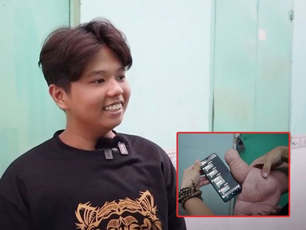 Chàng trai Sóc Trăng sở hữu ngón tay cái 'độc nhất vô nhị', ai gặp cũng nhìn chằm chằm và phản ứng bất ngờ