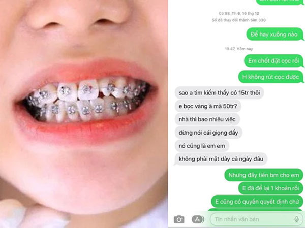 Biết bố mẹ vợ cho 50 triệu để vợ đi niềng răng, chồng đòi để tiền đấy lo cho em gái: 'không biết thân biết phận thì cút!'