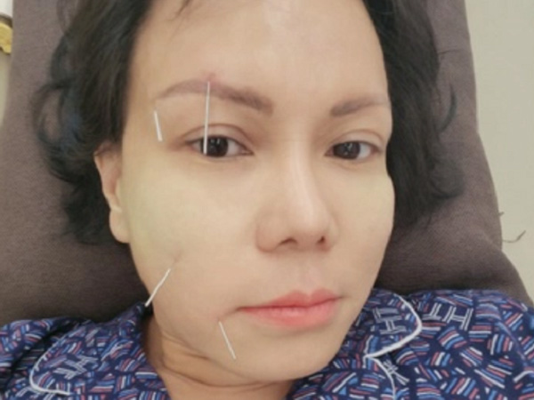 Từ vụ Việt Hương bị méo mặt, bác sĩ chỉ ra thói quen gây bệnh nhiều người mắc phải