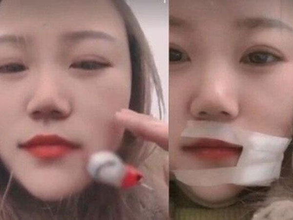 Người vợ bị chồng quăng móc câu trúng má khi đang đi câu cá với nhau