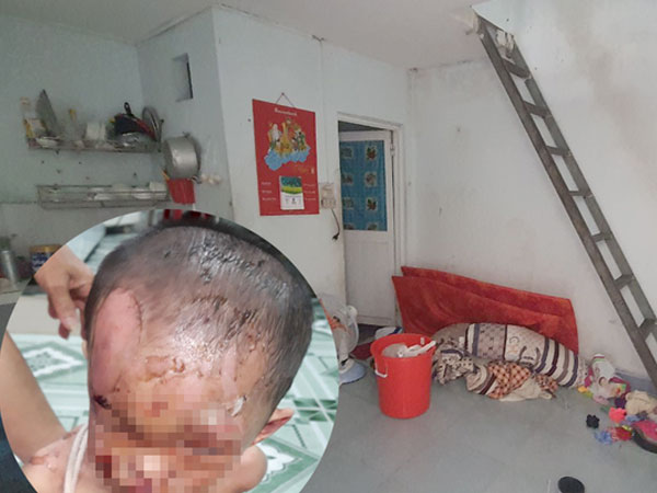 Vụ bé trai nghi bị cha mẹ đánh đập dã man: Người thân cung cấp thông tin bất ngờ