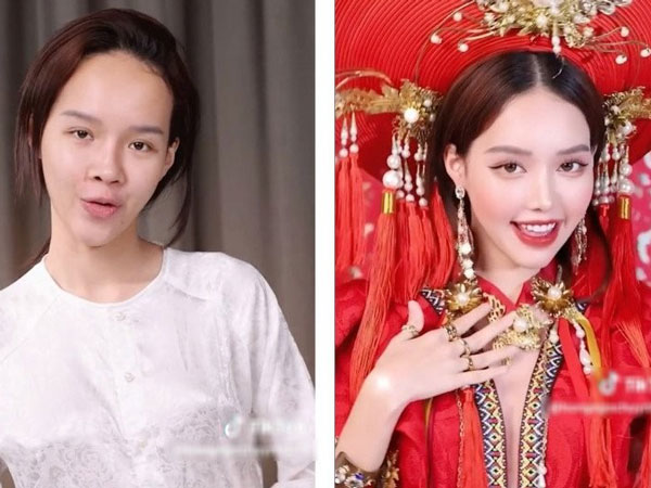TikToker 'vịt hoá thiên nga' chi 300 triệu sang Hàn sửa mũi tận 4 tiếng, thuê 2 người đi theo bảo vệ