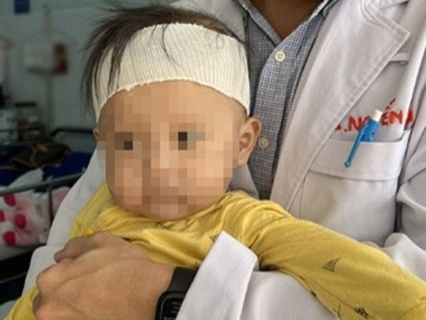Bé 10 tháng tuổi nguy kịch sau khi ăn cháo lươn: Nằm viện 3 tháng, tốn 100 triệu đồng