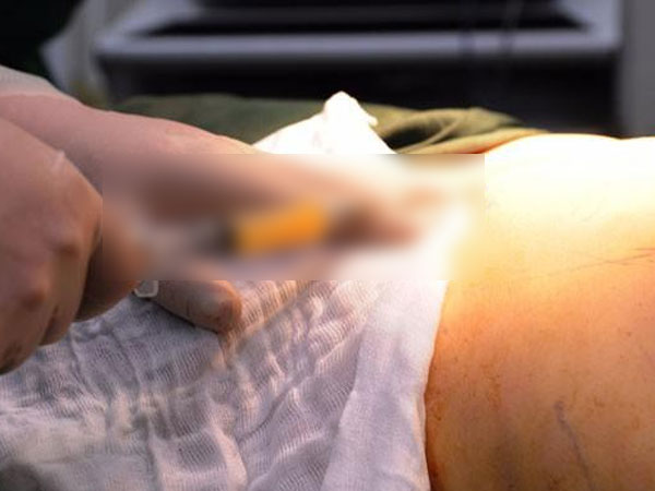 Người phụ nữ nước ngoài tử vong sau khi hút mỡ ở TP.HCM