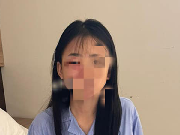 Nữ sinh lớp 8 ở Hà Nội bị đánh hội đồng phải nhập viện: Công an vào cuộc điều tra