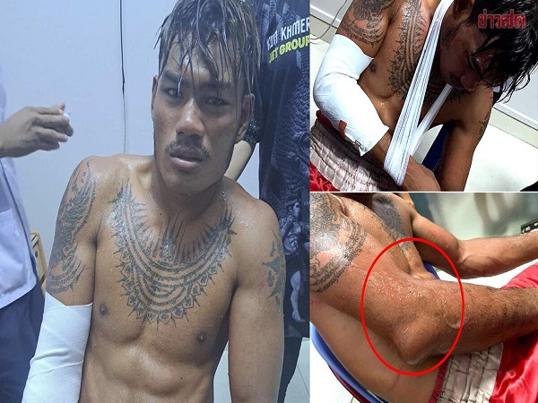 Bị cao thủ Thái Lan đánh gãy tay, võ sĩ số 1 Campuchia đau đớn xin hàng