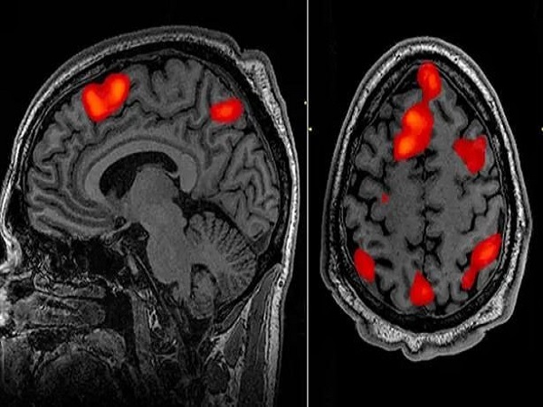 AI có thể đọc suy nghĩ và biến nó thành văn bản?
