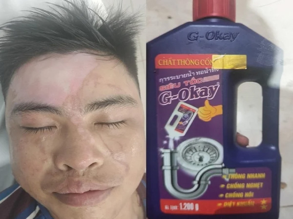 CẢNH BÁO: Nhiều người bỏng nặng khi dùng nước thông cống siêu tốc