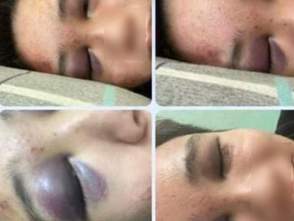 Nam sinh lớp 10 ở TP.HCM bị bạn đánh nhập viện