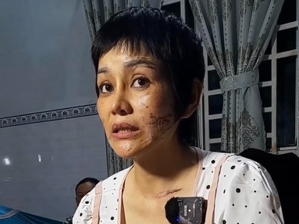 Công an vào cuộc vụ vợ bầu 7 tháng 'tố' chồng bạo hành dã man