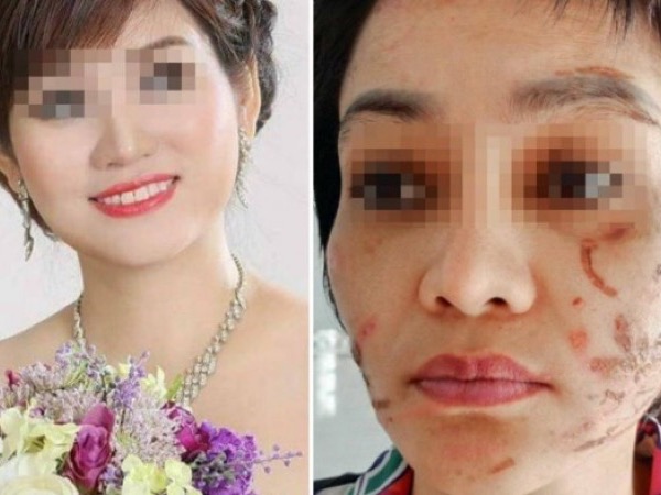 Vụ chồng đánh vợ mang bầu 7 tháng dã man: Người chồng nói chỉ đánh vợ bằng dây thắt lưng