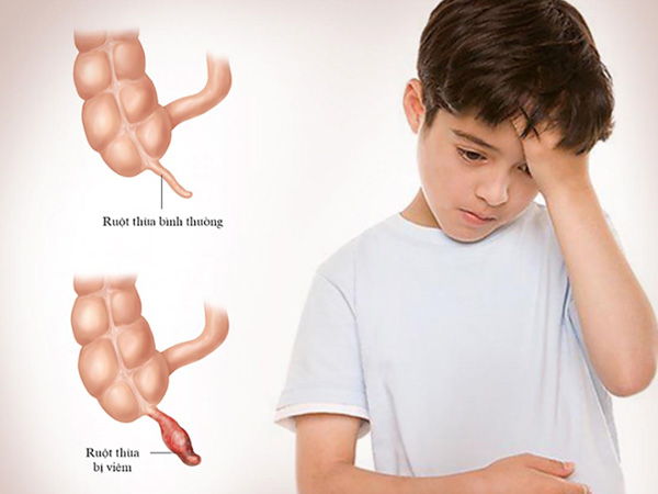 Bé 8 tuổi phải mổ cấp cứu vì gia đình mải đi du lịch
