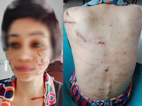 Công an tìm thấy 205 vết thương trên thân thể người vợ mang bầu 7 tháng