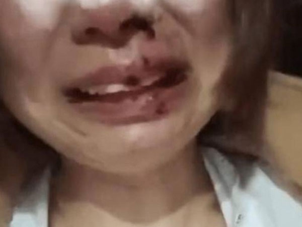 Mua đồ ăn đến thăm con, người phụ nữ bị gia đình chồng cũ lao vào đánh đập