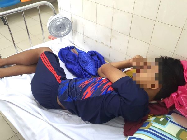 Trẻ ngộ độc botulinum ở TP.HCM ăn gì trước khi nhập viện?