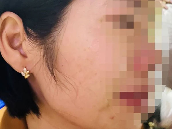 Tình tiết mới vụ phụ huynh đánh cô giáo vì con bị hạnh kiểm trung bình