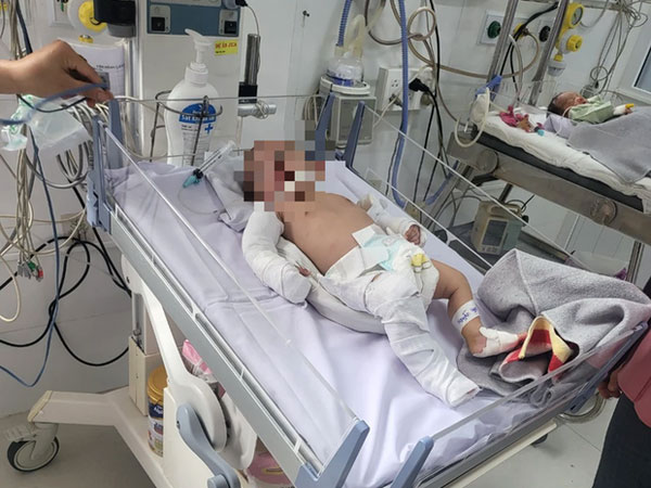 5 lần bị bạo hành dã man khiến bé gái 2 tháng tuổi chấn thương sọ não, gãy đa xương