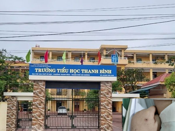 Vụ học sinh tử vong với nhiều thông tin trái chiều tại Hải Dương: Có hiện tượng rò rỉ điện