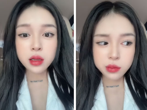 Cô gái Hà Nội liệt nửa mặt vì tắm đêm: Bác sĩ chuyên khoa thần kinh giải đáp về bệnh và cách phòng tránh