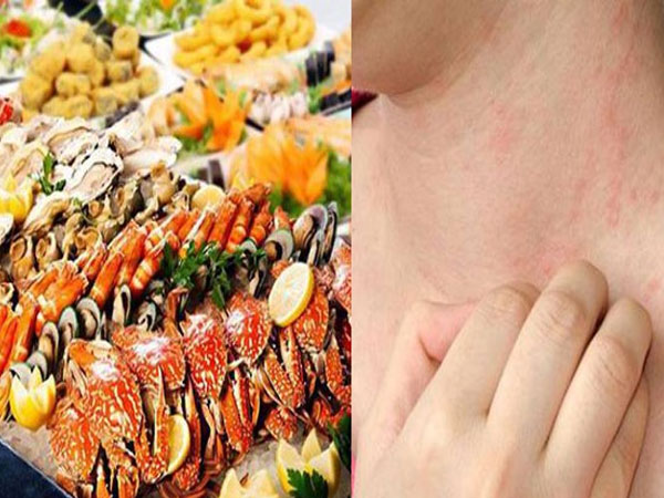 Một người bất ngờ tử vong sau khi ăn cua biển, cần làm gì để phòng ngừa ngộ độc hải sản?