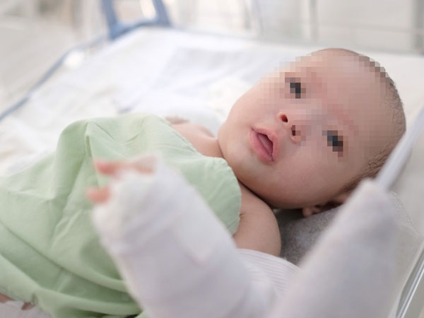 Đưa bé gái 3 tháng tuổi bị người tình của mẹ bạo hành vào Trung tâm bảo trợ xã hội chăm sóc