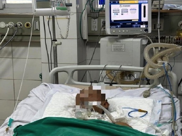 Bị gạch rơi vào ngón chân, nam thanh niên phải thở máy điều trị uốn ván