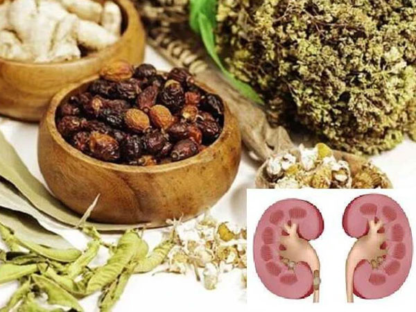 Suýt mất quả thận vì tự ý điều trị sỏi thận bằng thuốc đông y