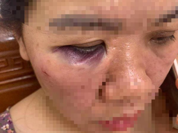 Nhân viên điện lực ném dép, đấm vào mặt nữ đồng nghiệp