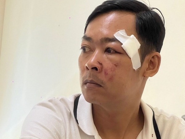 Người đàn ông vừa rời trụ sở Tòa án thì bị anh họ hành hung, 'rạch mặt'