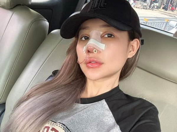 Ngân 98 công khai sửa mũi lần thứ 8, thừa nhận 'đau dã man' nhưng vẫn làm để có vẻ ngoài ưng ý