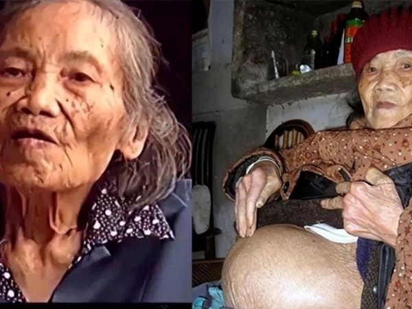 Cụ bà 91 tuổi đi khám phát hiện có thai, bí mật giấu 60 năm cuối cùng cũng lộ