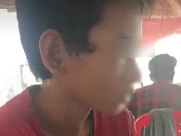 Bé trai 14 tuổi bị cha dượng đánh đập, dùng bật lửa đốt bộ phận sinh dục