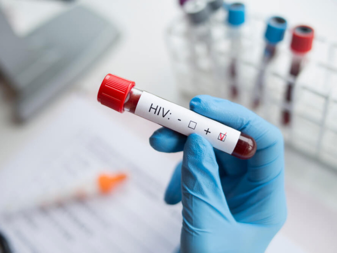 Đi làm móng nhiễm HIV: Bác sĩ nói gì?