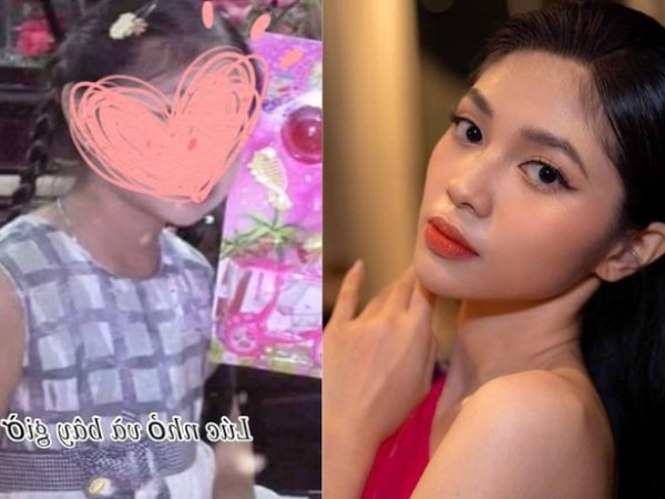 Ảnh lúc nhỏ giúp Á hậu Minh Kiên thoát nghi vấn thẩm mỹ 1 điểm trên mặt