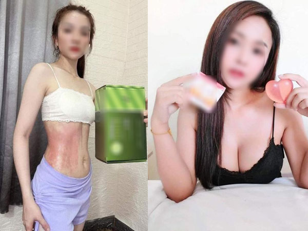 Top 5 biện pháp làm đẹp không khoa học tràn lan MXH, chị em học theo dễ 'tiền mất tật mang'