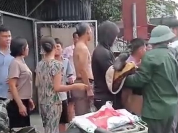Xin tiền không được, con tưới xăng đốt nhà khiến mẹ bỏng nặng
