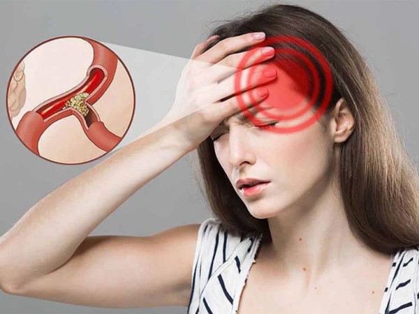Vì sao bệnh thiếu máu não thường gia tăng vào mùa hè?