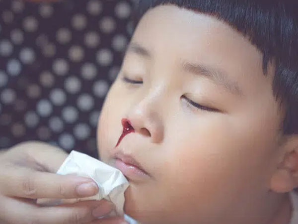Bà nội xử lý chảy máu cam sai cách, cháu trai 3 tuổi suýt mất mạng