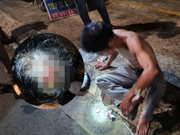 Từ chối vá xe giữa đêm, thành viên đội SOS bị hai kẻ lạ mặt đánh vỡ đầu