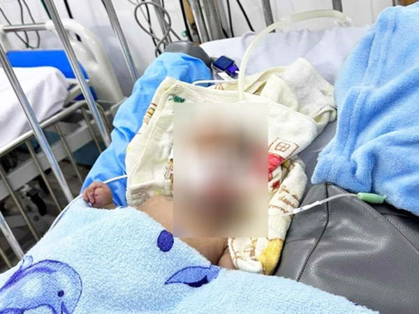 Bé trai 3 tháng tuổi tử vong nghi bị bạo hành: Bệnh viện Nhi Đồng 2 thông tin