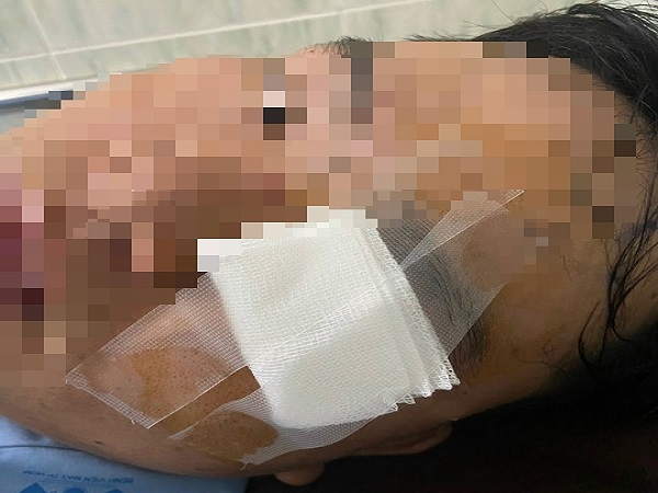 Nam thanh niên nhập viện vì 'va vào gậy của CSGT' nói gì?